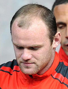 Wayne Rooney Before