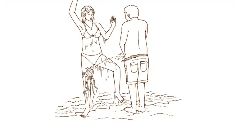 Jellyfish Sting Jellyfish Sting