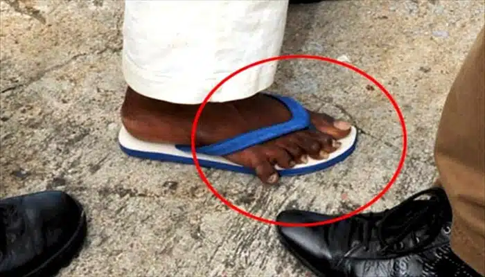 sixtoes six toes