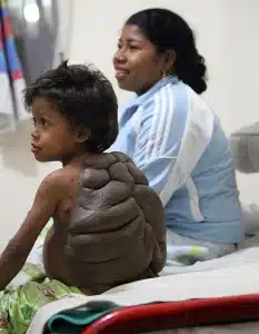 Turtle-Boy channel 4