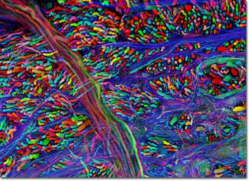 Brainbow - Brain Stem Brainbow - Brain Stem