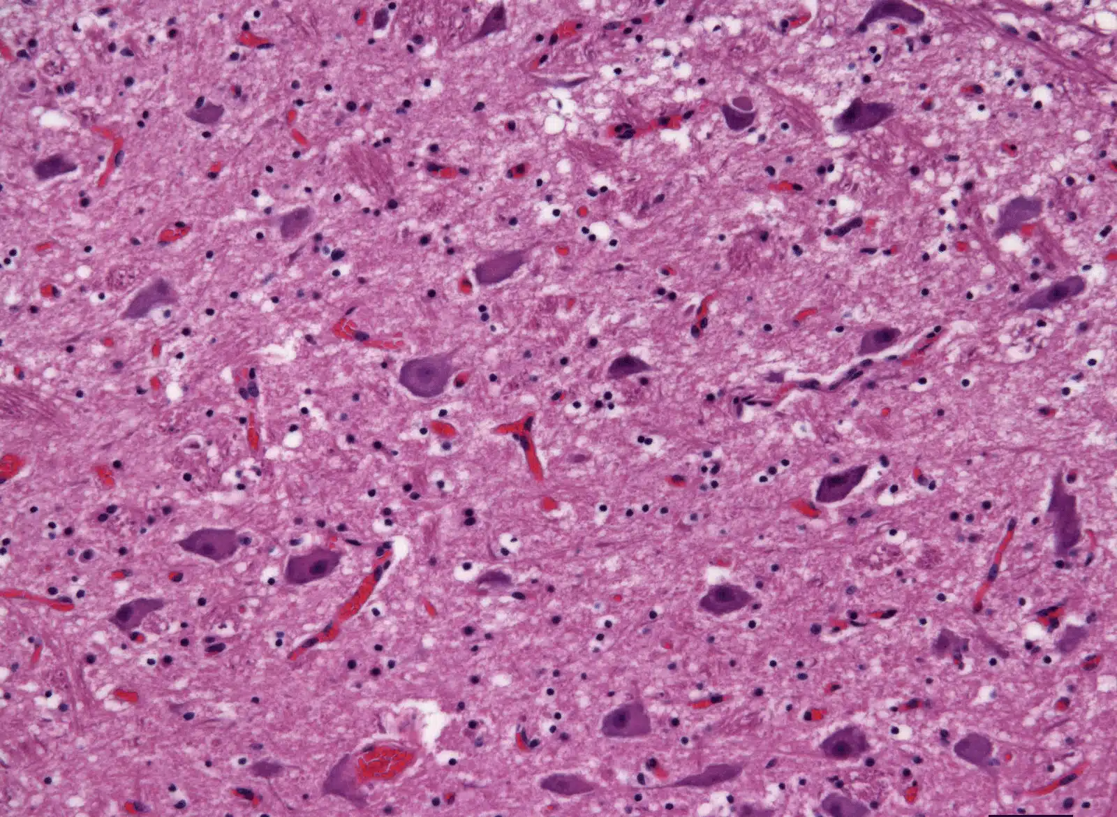 Healthy Cow Brain Image Healthy Cow Brain