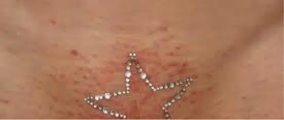 Vajazzle Bad Vajazzle