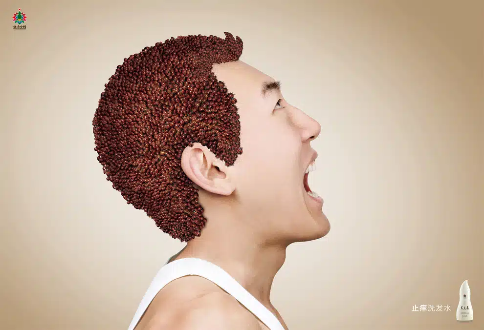 creepy crawly dandruff ad 1 creepy crawly dandruff ad 1