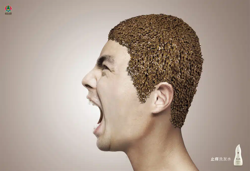 creepy crawly dandruff ad 2 creepy crawly dandruff ad 2