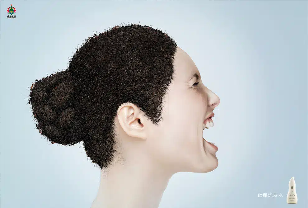 creepy crawly dandruff ad 3 creepy crawly dandruff ad 3