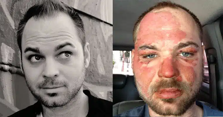before and after cover