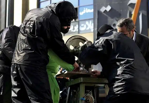 Iran Finger Amputation 8 Iran Finger Amputation 8