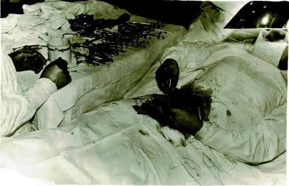Leonid Rogozov - appendectomy 2 Leonid Rogozov - appendectomy 2