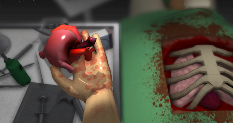 Open Heart Surgery Simulation Game