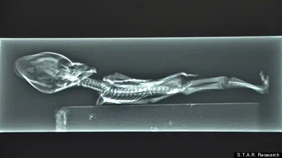 Ataxcama Humanoid Alien - Sirius - X-Ray