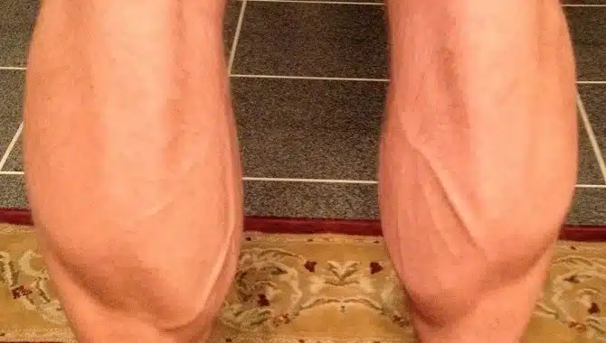 Calves