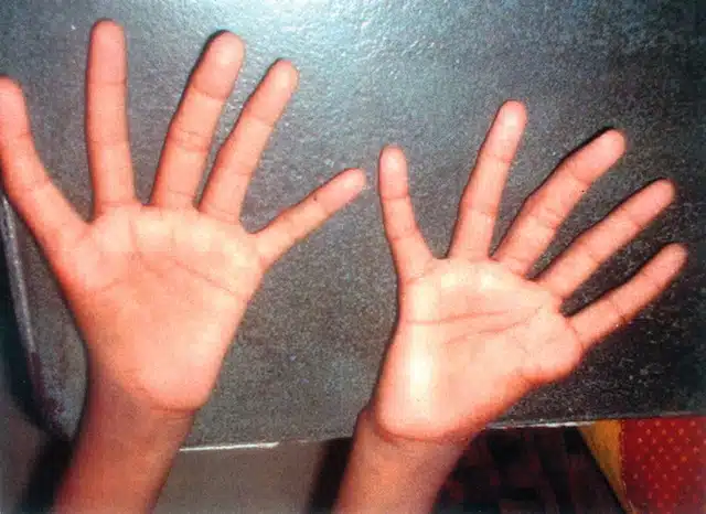 5 fingers