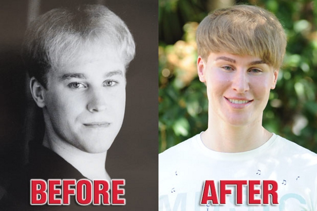 Toby Sheldon Justin Bieber Before And After