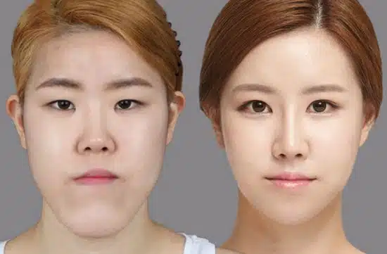 korea 4