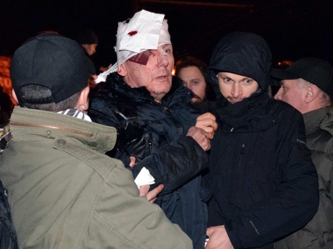 Ukraine Naked Protestor - Injured