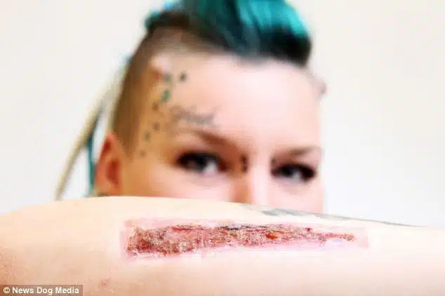 Woman Cuts Off Tattoo And Sends To Ex Boyfriend 1