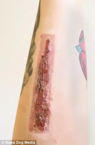 Woman Cuts Off Tattoo And Sends To Ex Boyfriend 2