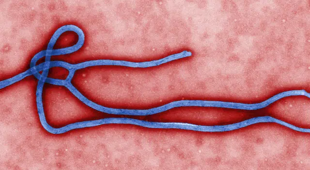 Ebola Virus