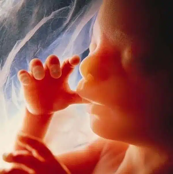 Prenatal Photos 6