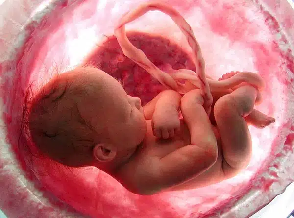 Prenatal Photos 9