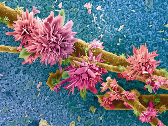 Wellcome Image Awards - Agricultural sludge