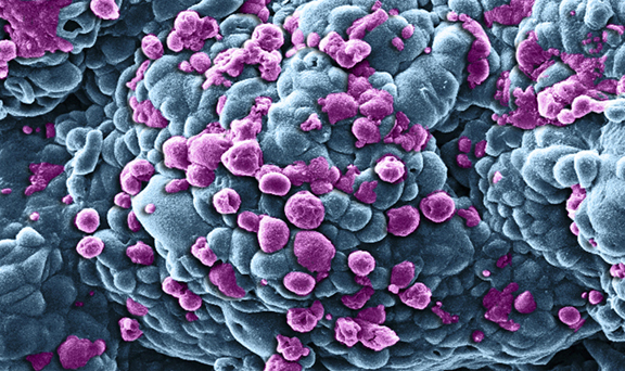 Wellcome Image Awards - Breast cancer treatment