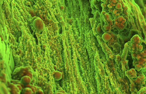 Wellcome Image Awards - Hardening of heart tissue