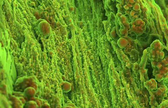 Wellcome Image Awards - Hardening of heart tissue