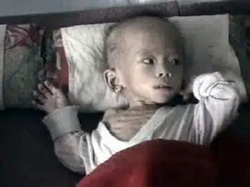 North Korea Starving Account - baby