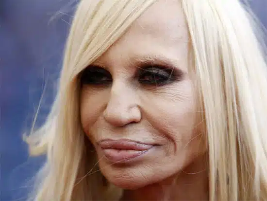 Plastic Surgery Gone Wrong 15