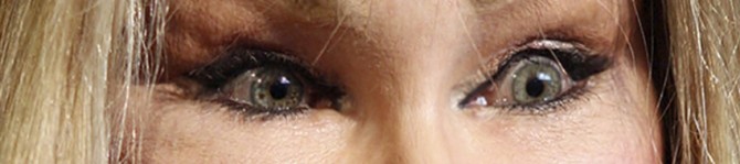 Jocelyn Wildenstein - eyes