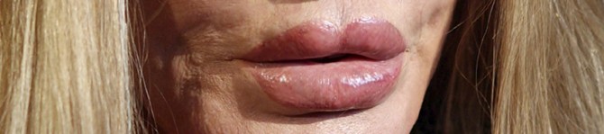 Jocelyn Wildenstein - lips