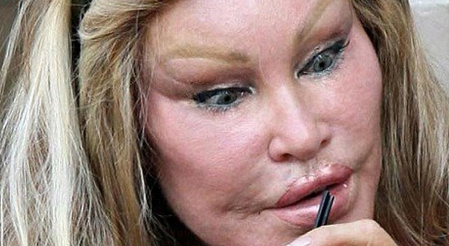 Bilderesultat for plastic surgery gone wrong