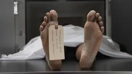 Back From Death Reanimation - body