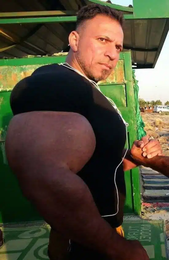 synthol and steroid bodybuilder 12