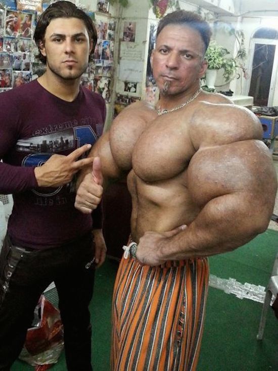 synthol and steroid bodybuilder 17