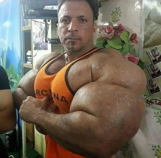 synthol and steroid bodybuilder 2