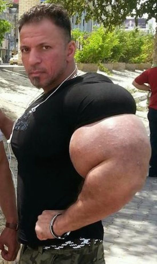 synthol and steroid bodybuilder 21