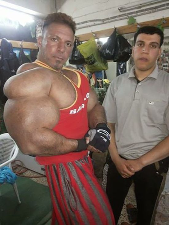 synthol and steroid bodybuilder 22