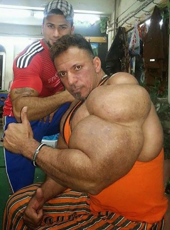 synthol and steroid bodybuilder 4