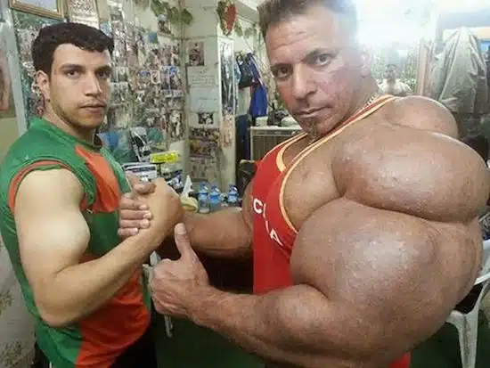 synthol and steroid bodybuilder 6