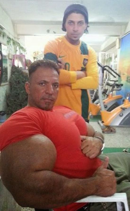 synthol and steroid bodybuilder 7
