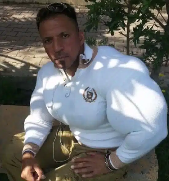 synthol and steroid bodybuilder 8