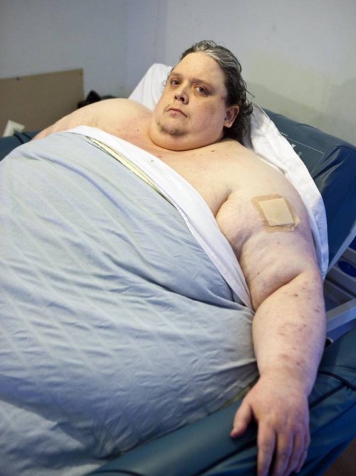 Britain's Fattest Man 2