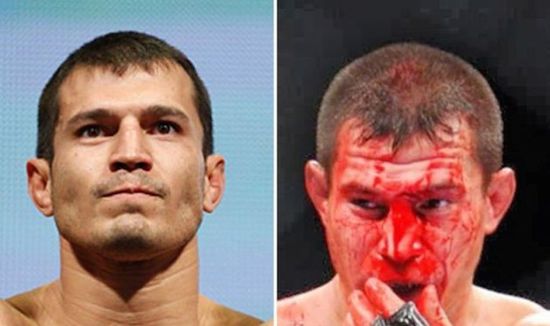 MMA Before And After 1