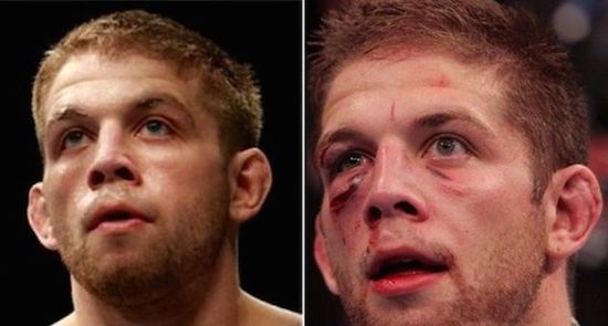 MMA Before And After 11