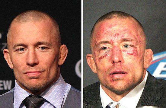 MMA Before And After 18