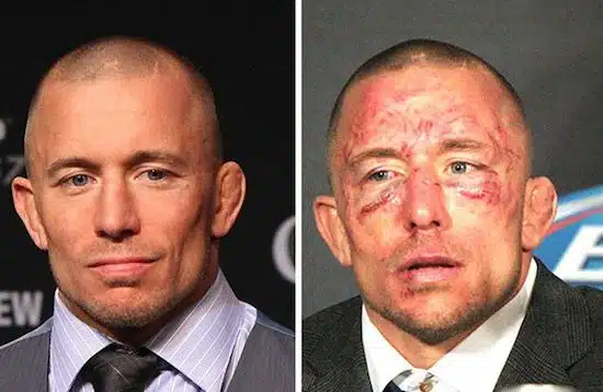 MMA Before And After 18