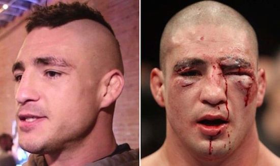 MMA Before And After 2